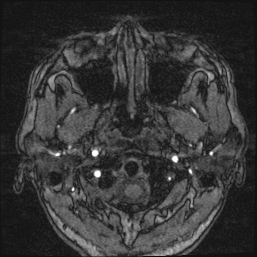 Click on the Serie image to view the images of VILLANUEVA, WILLIAM A.